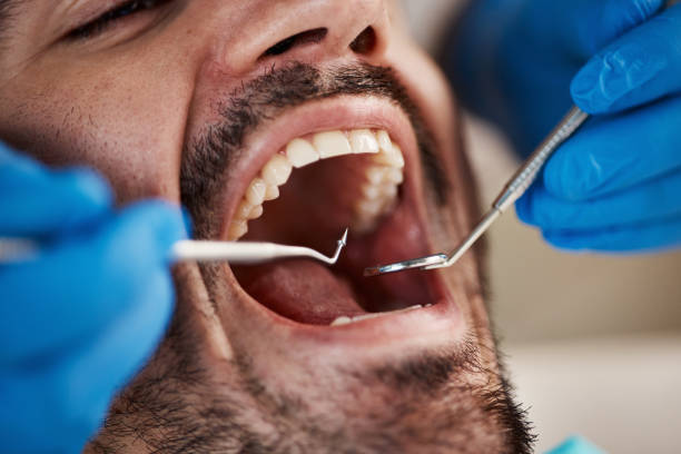 Tooth Infection Emergency Dentist in VA